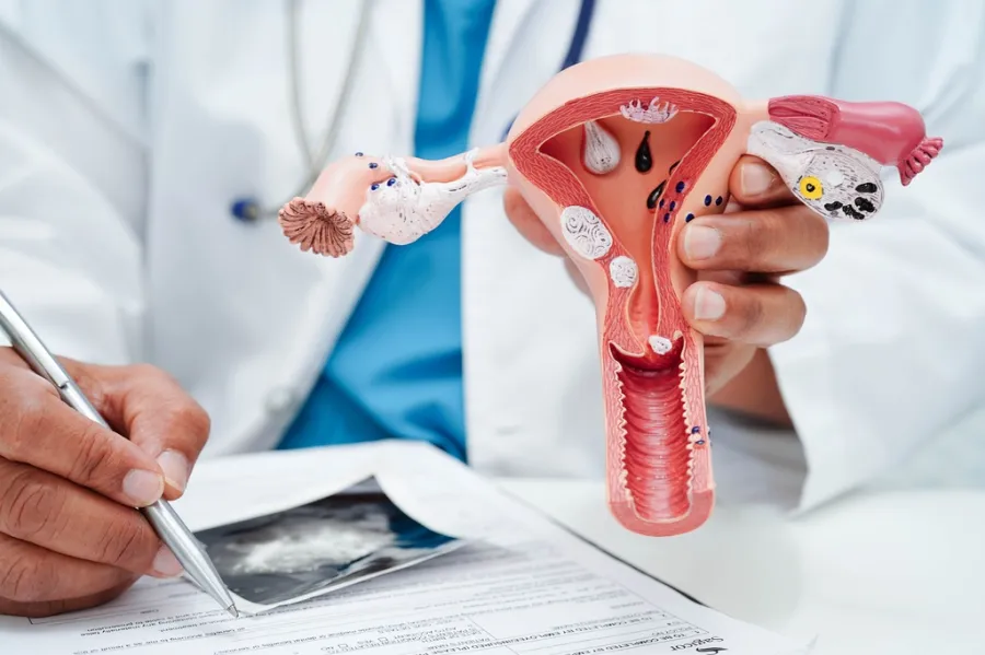 Healthcare provider using a reproductive anatomy model to explain how HPV affects the cervix and why screening matters.