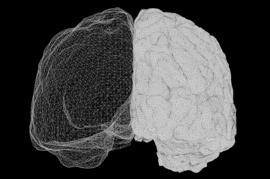 An image of a brain scan