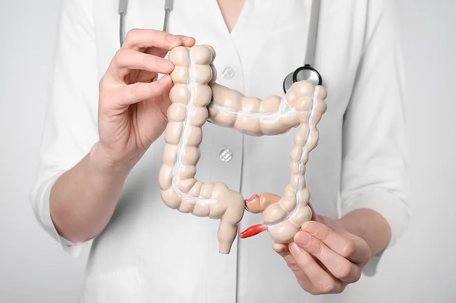 Medical professional holding model of the colon