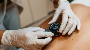 Gloved hands using a microscope on a patient's back. 