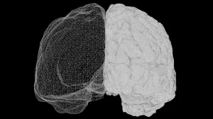 An image of a brain scan