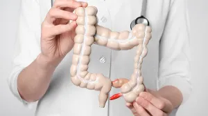 Medical professional holding a model of a colon