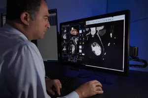 A CRA radioligist at Tufts Medical Center is reviewing a patient's cardiovascular (heart) scan on the computer.