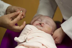 Baby with cleft lip palate