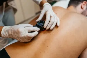 Dermatologist conducting a skin cancer screening on a patient